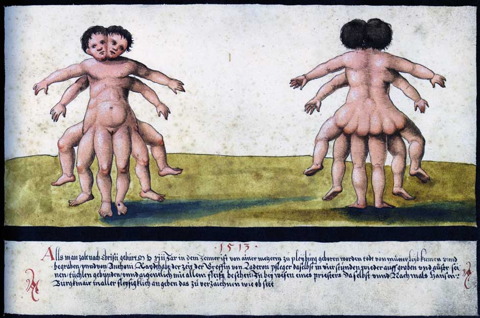 Monstrous Birth from The Book of Miracles 