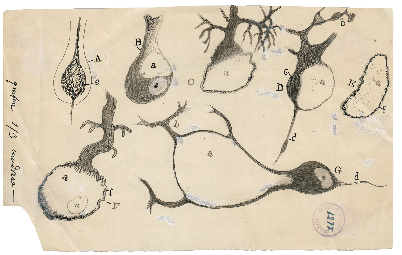 Drawing of injured Purkinje neurons of the cerebellum, 1914