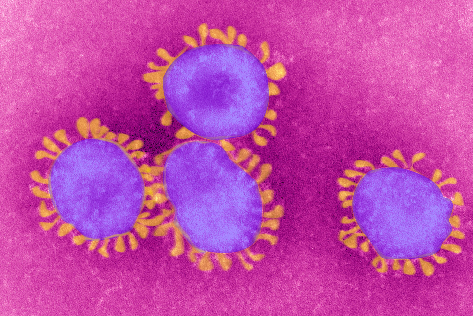 A colorized image of a coronavirus made from transmission electron microscopy, February 21, 2008