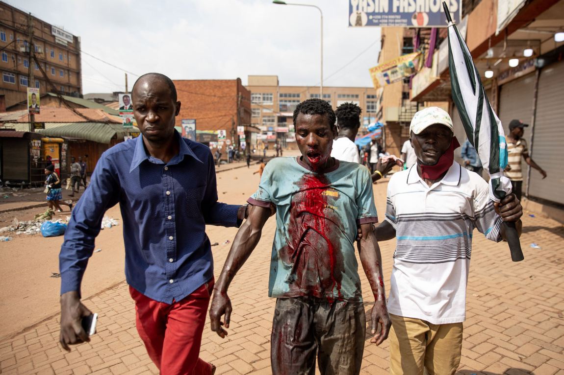 An injured protester in Uganda