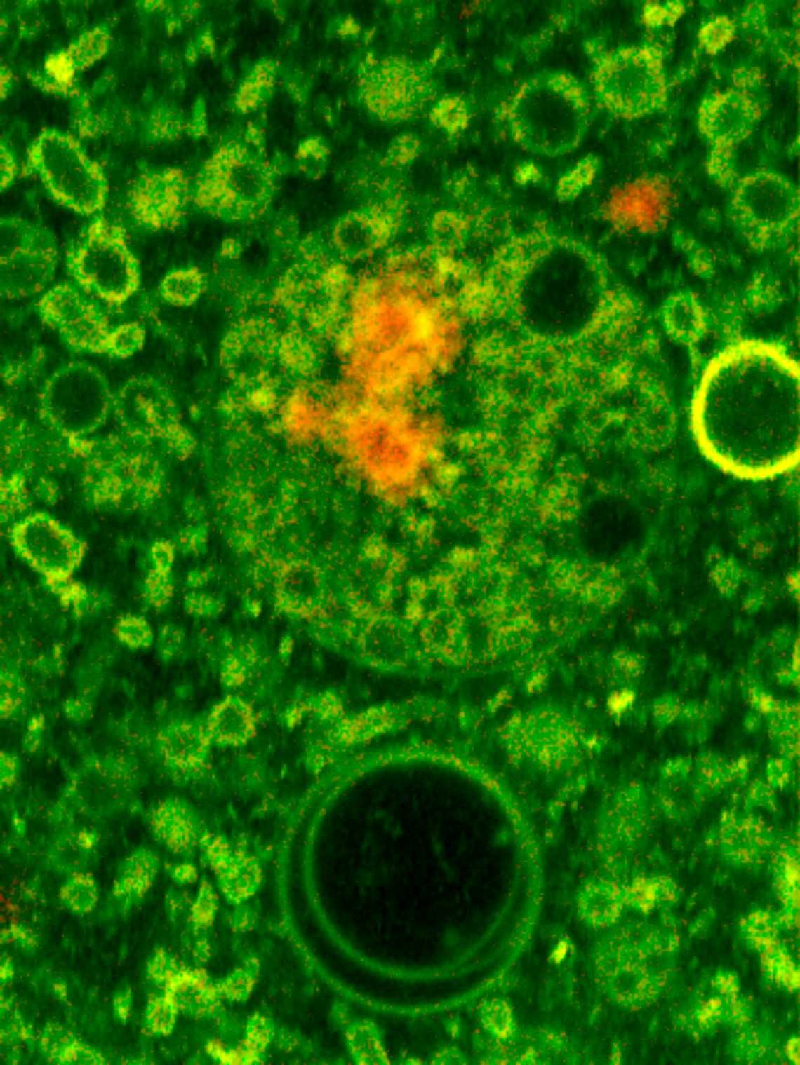 Fatty acid vesicles encapsulating RNA molecules attached to clay; image from an experiment conducted to determine how the first cells may have been formed